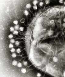 electron micrograph of bacteriophages medium