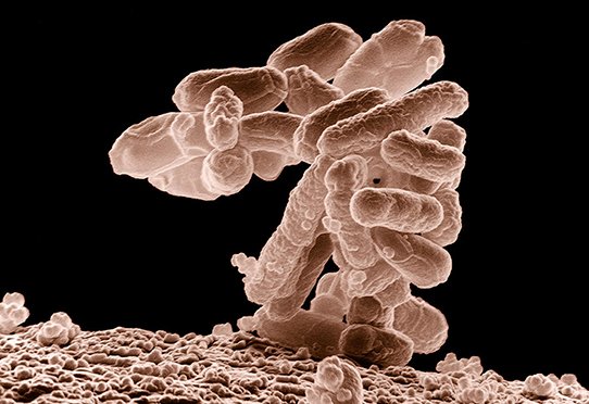 Low-temperature electron micrograph of a cluster of E. coli bacteria, magnified 10,000 times. Each individual bacterium is oblong shaped © Photo by Eric Erbe, digital colorization by Christopher Pooley, both of USDA, ARS, EMU. - This image was released by the Agricultural Research Service, the research agency of the United States Department of Agriculture, with the ID K11077-1