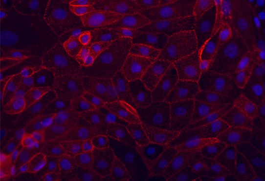 Différenciation de cellules souches embryonnaires humaines en progéniteurs hépatiques. Les cellules (noyaux cellulaires en bleu) expriment la molécule d'adhésion Epcam (en rouge)