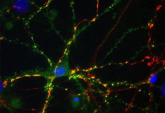Rat embryonic neurons.  After 14 days of culture, they were transfected with a plasmid encoding the wild-type form of the gamma 2 subunit of the GABA receptor (GABRG2), a neurotransmitter involved in epilepsy, then left in culture for an additional 19 days before fixation. and staining by immunofluorescence.  The cell nuclei are marked in blue by Dapi, Gabrg2 is marked in green and the inhibitory synapses are marked in red by an anti-GAD6 antibody (GAD65 + GAD67).