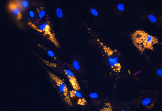 Adipocytes en culture obtenus à partir de cellules souches mésenchymateuses (gouttelettes lipidiques en jaune, noyaux en bleu).