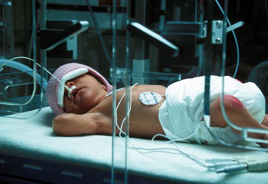 Prématurés, nouveau-nés en couveuse © Inserm/Depardieu, Michel