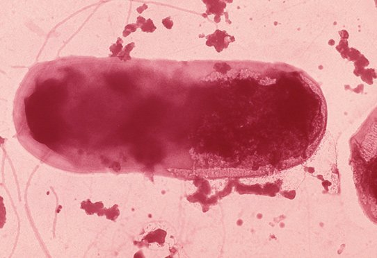Escherichia Coli, entérobactérie, hôte normal du tube digestif. Escherichia Coli a été très utilisée par les généticiens. Certaines souches peuvent être pathogènes (infections urinaires).