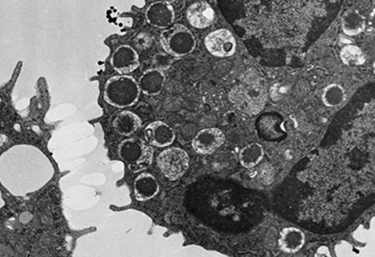 Mastocyte, ce granulocyte est capable, par exocytose de ses vésicules visibles dans le cytoplasme périphérique, de libérer de l'histamine.