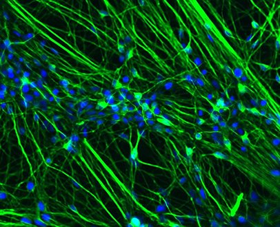 Réseau de Neurones dérivés de cellules iPS