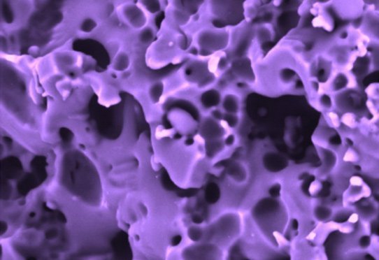 CoPEC (polyélectrolytes compacts), matériau tridimensionnel poreux fabriqué par assemblage de polyélectrolytes ultracentifugés. Image réalisée à l'U1121 "Biomatériaux et Bioingénierie", Strasbourg.