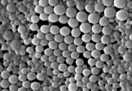 Image de nanoparticules polymères en microscopie électronique à balayage. Laboratoire MSSMat Ecole Centrale Paris, Inserm U698.
