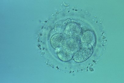 mbryon humain à huit cellules observé 72 heures après fécondation