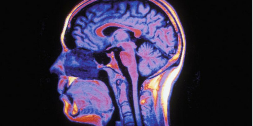 Cerveau humain en IRM, coupe sagittale. 