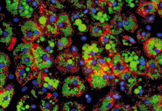 cellules progénitrices issues de tissu adipeux humain différenciées in vitro en adipocytes beiges