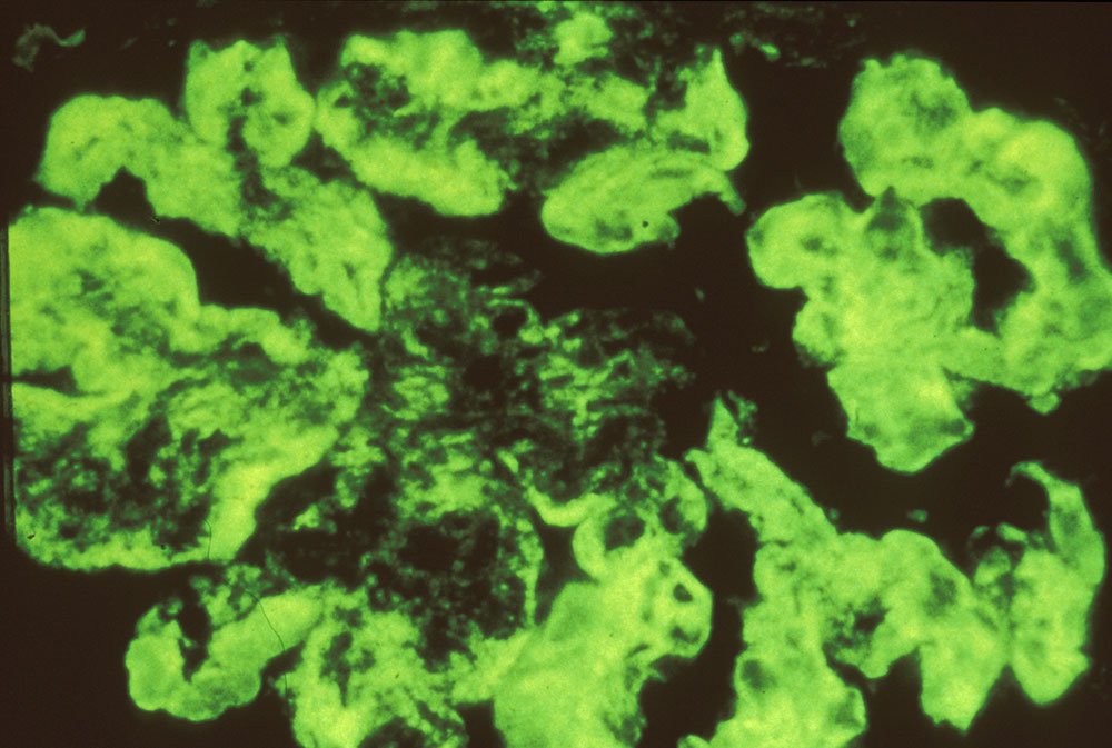 Image réalisée par microscopie en fluorescence