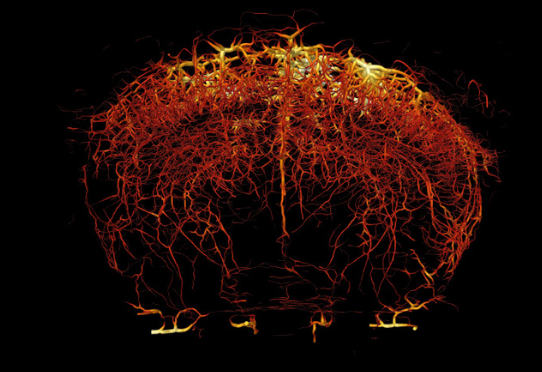 Tomographie ultrarapide par doppler de la vascularisation d'un cerveau de rat.