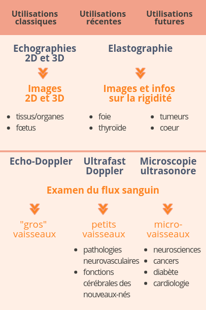 Utilisations diagnostiques des ultrasons - Echographie, élastographie, écho-Doppler, Ultrafast Doppler, microscopie ultrasonore