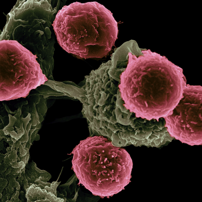 Cette image au microscope électronique à balayage montre des cellules dendritiques (en vert), en interaction avec des lymphocytes T (en rose). © Victor Segura Ibarra et Rita Serda, Ph.D., National Cancer Institute, National Institutes of Health