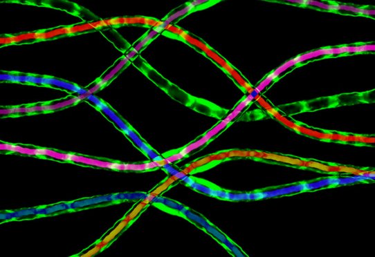 Fibres myélinisées du nerf périphérique de souris en microscopie confocale. Les cellules de Schwann myélinisées sont colorées en vert par la GFP qu'elles expriment et les axones qu'elles myélinisent sont surajoutés en couleur.
