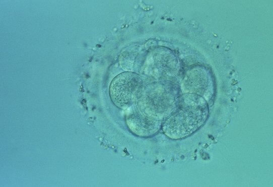 Human embryo © Inserm/Lassalle, Bruno