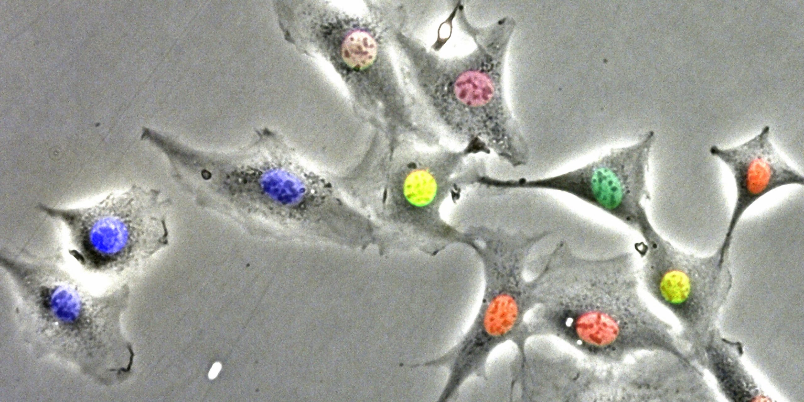 Photographie issue d'une vidéomicroscopie en fluorescence de fibroblastes de souris en prolifération, transformés avec un système rapporteur d’horloge (en vert) et du cycle cellulaire (en rouge et bleu). © Inserm/iBV/C. Feillet