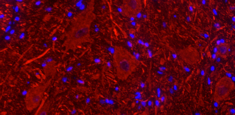 Motoneurones, image de microscopie à fluorescence 