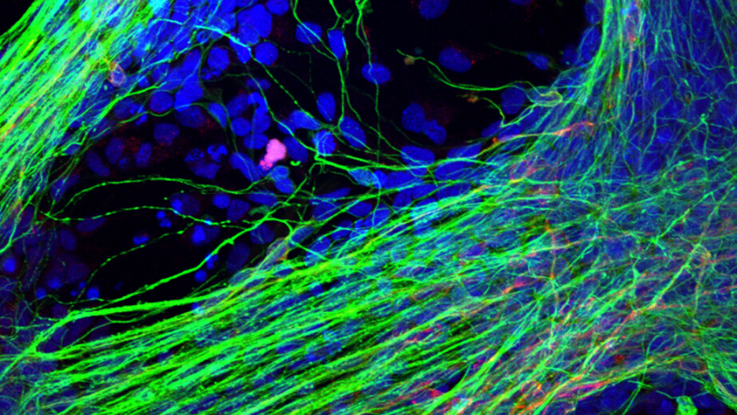 Neurones obtenus à partir des cellules souches pluripotentes induites