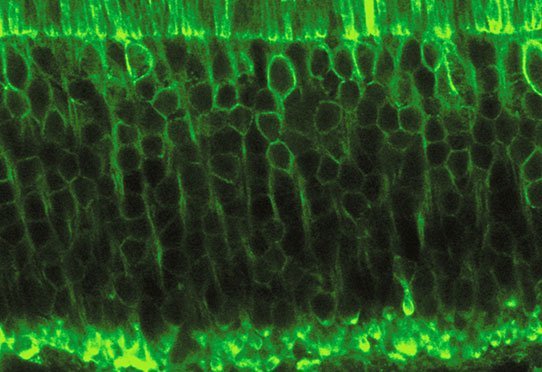 Des photorécepteurs de souris expriment la protéine optogénétique halorhodopsine en vert. © Inserm/Khabou, Hanen