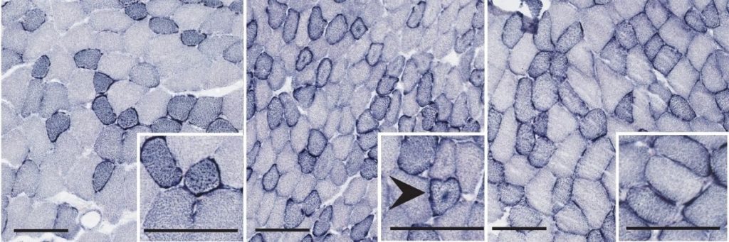 Trois images obtenues par microscopie, présentant l'aspect des cellules d'un muscle souris