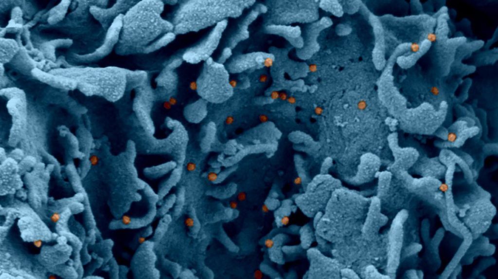 Visualisation en microscopie électronique d’une cellule infectée par le SARS-CoV-2