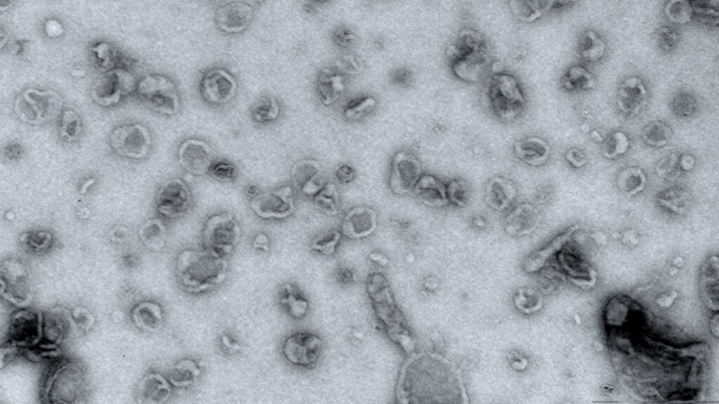 Une image obtenue par microscopie électronique, en nuance de gris