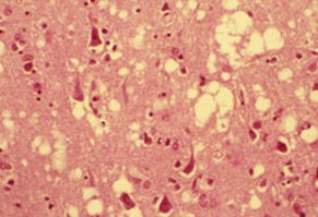[2016-02-24] INFRv4_maladies à prions_IAU.jpg