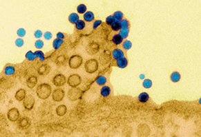[2016-05-25] INFRv4_chikungunya, facteurs cellulaires clés_IAU.jpg