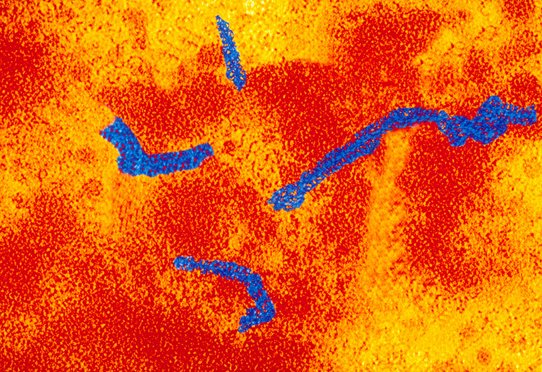 [2017-03-23] INFRv4_dermatite, rougeole_IAU.jpg