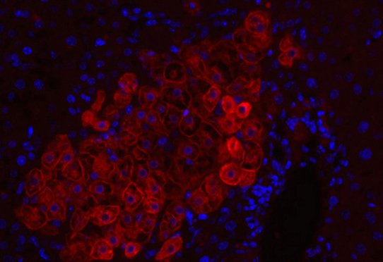 Marquages sur foie de souris humanisée: ce sont des souris imunodéficientes et hépatodéficientes auxquelles on a gréffé des hépatocytes, cellules de foie, humain. 4 à 8 semaines plus tard, elles sont infectées par le virus de l'hépatite C. Marquage de la cytokératine 18 humaine, marqueur des hépatocytes humains, en immunofluorescence en rouge et contre-coloration des noyaux en bleu. Cette image montre qu'il y a un remplacement d'environ 50% du foie de souris par du foie humain. Grossissement x20.