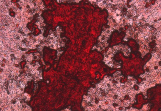 Tinción con rojo de alizarina de células madre mesenquimales diferenciadas en osteoblastos.  Las células madre mesenquimales (MSC) son células madre tisulares multipotenciales que dan lugar a los tejidos conectivos esqueléticos.  Los osteoblastos son las células responsables de la formación de hueso, asegurando la producción de matriz orgánica.