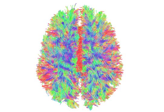 Représentation 3D transversale d'un cerveau humain avec ses faisceaux de fibres nerveuses obtenue par IRM de tenseur de diffusion © Inserm/Arribarat, Germain