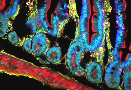 Section of intestinal tissue © CIML/Inserm/CNRS/Lelouard, Hugues/Fallet, Mathieu/Mailfert, Sébastien