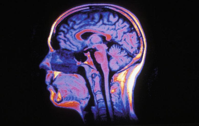 Cerveau humain en IRM