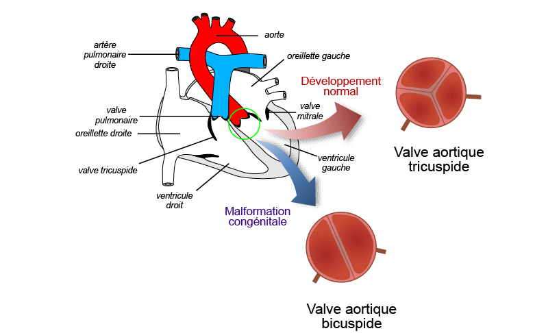 Anatomie cardiaque