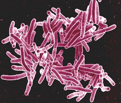 Bactérie Mycobacterium tuberculosis