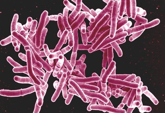 Bactérie Mycobacterium tuberculosis © NIAID