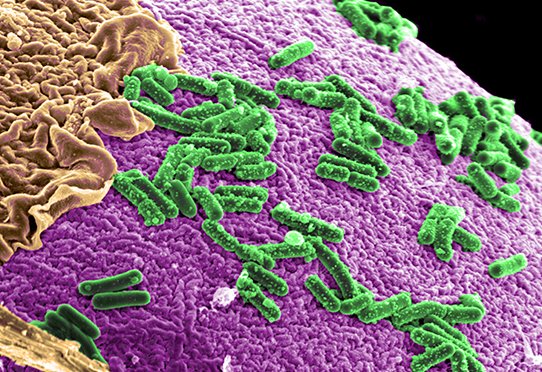 Le microbiote intestinal en cause dans les spondyloarthrites © Pacific Northwest National Laboratory - PNNL