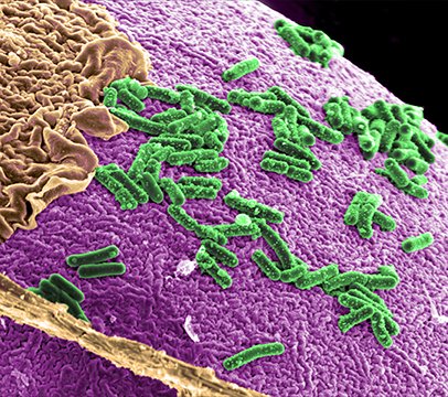 Microbiote intestinal © Pacific Northwest National Laboratory - PNNL