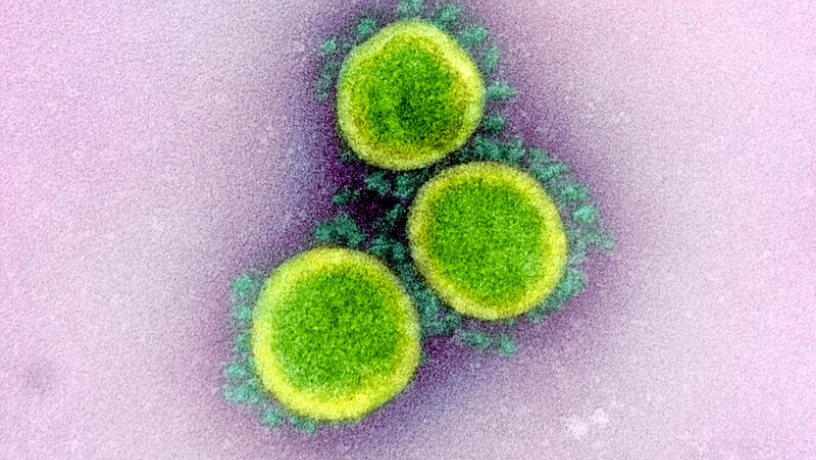 Micrographie électronique à transmission de particules du virus SARS-CoV-2